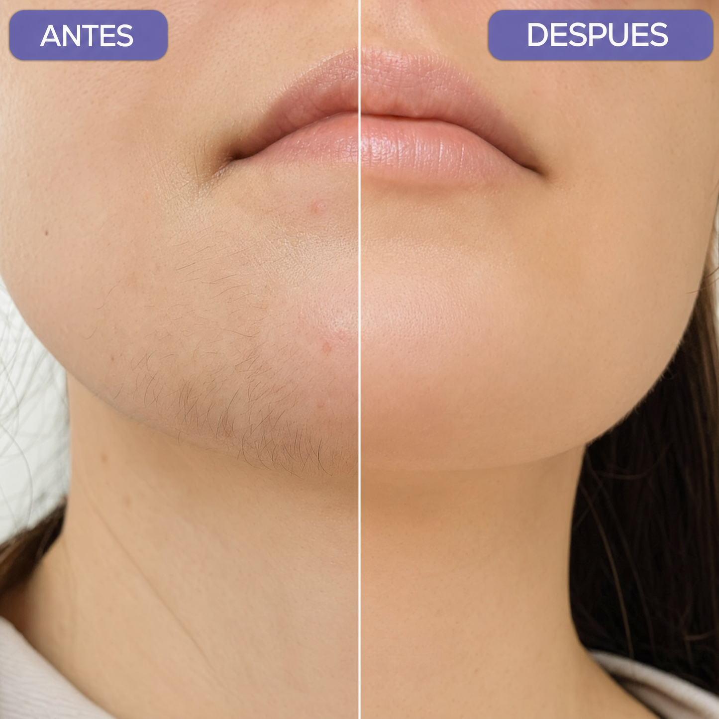 Depiladora Facial | Piel Lisa Sin Dolor Ni Ronchas (Lleva 3 paga 1)