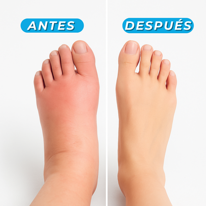 Electro Estimulador | Alivia el Dolor de Pies