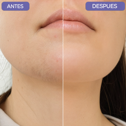 Depiladora Facial | Piel Lisa Sin Dolor Ni Ronchas (Lleva 3 paga 1)