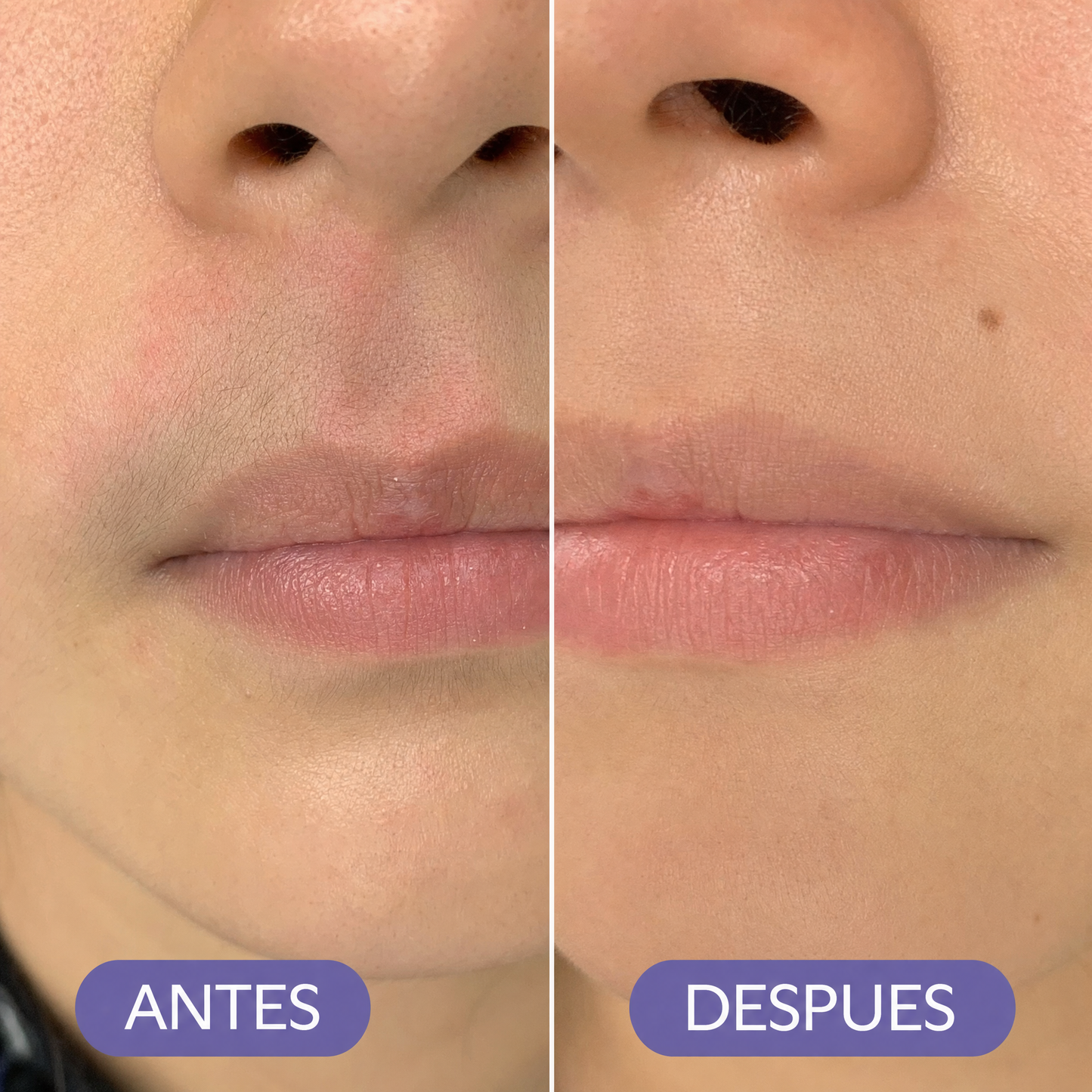 Depiladora Facial | Piel Lisa Sin Dolor Ni Ronchas (Lleva 3 paga 1)