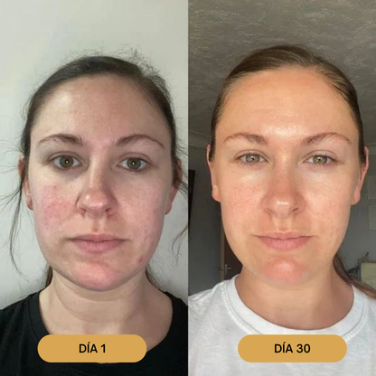 Bálsamo Facial Natural | Hidrata, Nutre y Protege