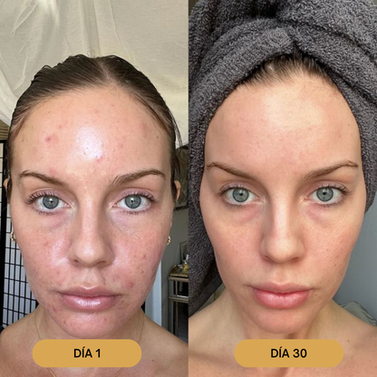 Bálsamo Facial Natural | Hidrata, Nutre y Protege